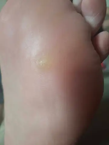 Foot and nail care at Fairy Feet