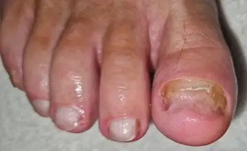 Foot and nail care at Fairy Feet