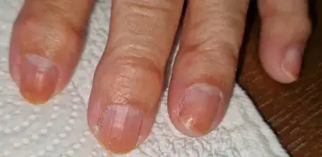Foot and nail care at Fairy Feet