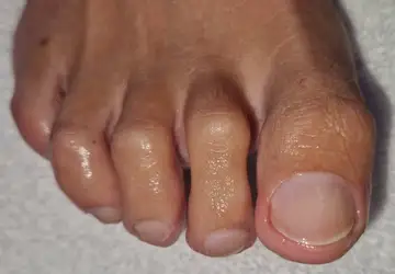 Foot and nail care at Fairy Feet