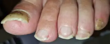 Foot and nail care at Fairy Feet
