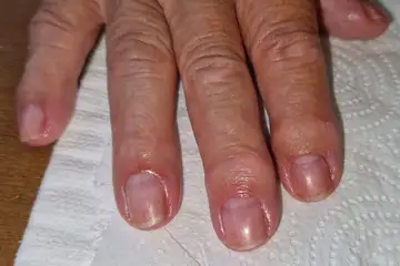Foot and nail care at Fairy Feet