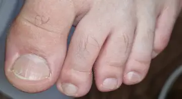 Foot and nail care at Fairy Feet