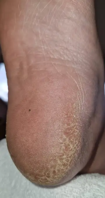 Foot and nail care at Fairy Feet
