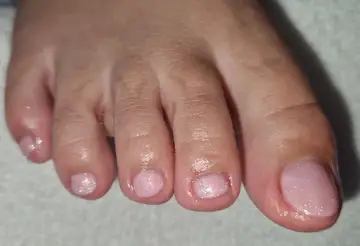 Foot and nail care at Fairy Feet
