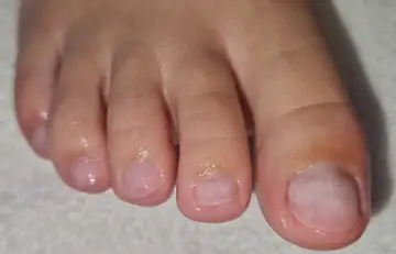 Foot and nail care at Fairy Feet
