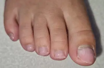 Foot and nail care at Fairy Feet