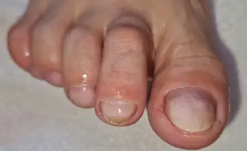 Foot and nail care at Fairy Feet