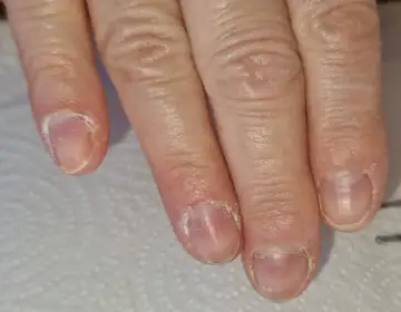 Foot and nail care at Fairy Feet