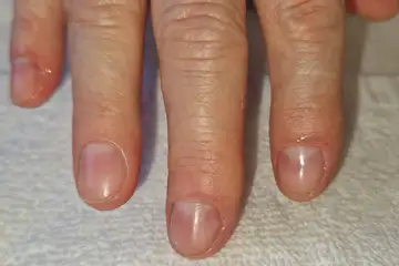 Foot and nail care at Fairy Feet