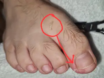 Foot and nail care at Fairy Feet