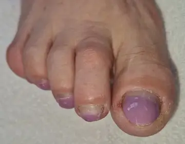 Foot and nail care at Fairy Feet