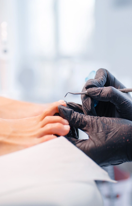 Medi pedicure & nail prosthesis